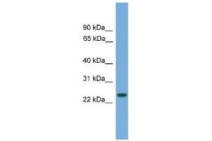WB Suggested Anti-C19orf18 Antibody Titration: 0. (C19orf18 抗体  (N-Term))