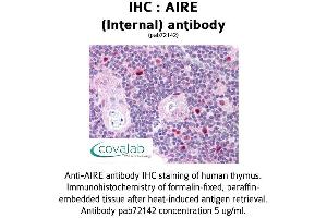 Image no. 1 for anti-Autoimmune Regulator (AIRE) (Internal Region) antibody (ABIN1731636) (AIRE 抗体  (Internal Region))