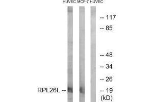 Western blot analysis of extracts from HUVEC cells and MCF-7 cells, using RPL26L antibody. (RPL26L1 抗体  (C-Term))