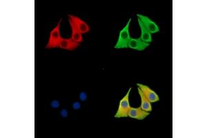 ABIN7096009 and ABIN7100071 staining Hela cells by IF/ICC. (CCDC90B 抗体)