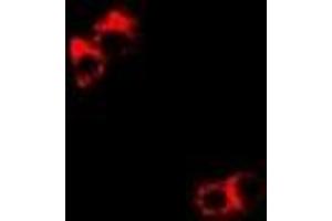 Immunofluorescent analysis of DDX1 staining in Hela cells. (DDX1 抗体)