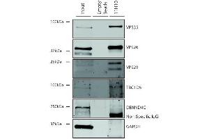 Immunoprecipitation analysis using Mouse Anti-VPS35 Monoclonal Antibody, Clone 11H10 (ABIN6933005). (VPS35 抗体  (Atto 390))