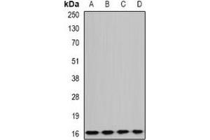 Western blot analysis of GABARAPL1 expression in BT474 (A), mouse liver (B), rat brain (C), rat kidney (D) whole cell lysates. (GABARAPL1 抗体)
