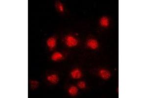 Immunofluorescent analysis of RB1 (pS807) staining in HeLa cells.