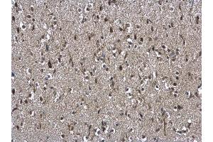 IHC-P Image NSFL1C antibody [N1C2] detects NSFL1C protein at cytoplasm and nucleus on mouse brain by immunohistochemical analysis. (NSFL1C 抗体  (Center))