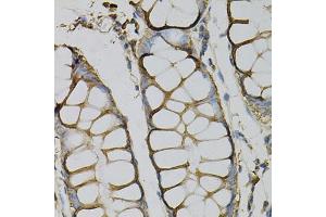 Immunohistochemistry of paraffin-embedded human colon using AZGP1 Antibody (ABIN1876553) at dilution of 1:100 (40x lens). (AZGP1 抗体)