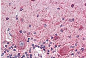 Human Brain, Cerebellum (formalin-fixed, paraffin-embedded) stained with ATF4 antibody ABIN462203 followed by biotinylated goat anti-rabbit IgG secondary antibody ABIN481713, alkaline phosphatase-streptavidin and chromogen. (ATF4 抗体  (N-Term))