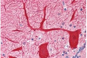 Human Brain, Cerebellum (formalin-fixed, paraffin-embedded) stained with OPTN antibody ABIN364456 at 2. (OPTN 抗体  (AA 559-575))