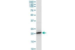 SAT polyclonal antibody (A01), Lot # 051213JC01. (SAT1 抗体  (AA 88-171))