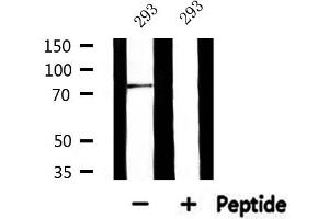 Western blot analysis of extracts from 293, using GUSB Antibody.