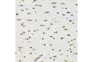 Immunohistochemistry (IHC) image for anti-Recombination Signal Binding Protein For Immunoglobulin kappa J Region (RBPJ) (AA 1-260) antibody (ABIN6146805)