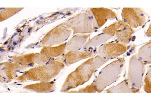 Detection of NRP1 in Human Skeletal muscle Tissue using Monoclonal Antibody to Neuropilin 1 (NRP1) (Neuropilin 1 抗体  (AA 646-814))