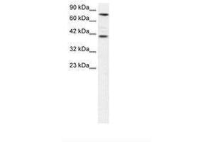 Image no. 1 for anti-Zinc Finger Protein 652 (ZNF652) (AA 97-146) antibody (ABIN6735826) (ZNF652 抗体  (AA 97-146))