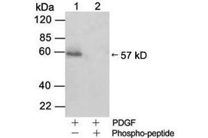 Western blot analysisLane 1: Cell lysate from NIH/3T3 cells stimulated with 50 ng/ml PDGFLane 2: Cell lysate from NIH/3T3 cells stimulated with 50 ng/ml PDGF and blocked with phosphopeptidePrimary Antibody: Rabbit Anti-Akt (Phospho-Ser473) Polyclonal Antibody (ABIN398632) Secondary Antibody: 0. (AKT1 抗体  (pSer473))