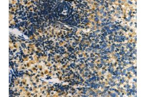 ABIN6261308 and ABIN6276956 at 1/100 staining Rat liver tissue by IHC-P.