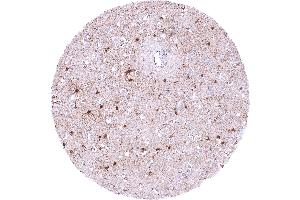 anti-phosphoserine Aminotransferase 1 (PSAT1) antibody