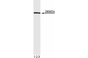 Western blot analysis of beta-Spectrin II on Jurkat lysate. (SPTBN1 抗体  (AA 2101-2189))