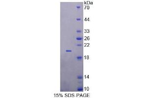 SDS-PAGE analysis of Human GALR4 Protein. (GPR151 蛋白)