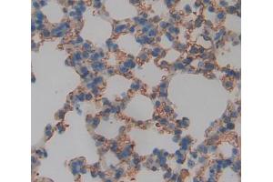Used in DAB staining on fromalin fixed paraffin- embedded lung tissue (ABCD4 抗体  (AA 356-606))