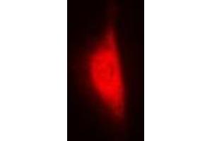 Immunofluorescent analysis of WBSCR22 staining in MCF7 cells. (WBSCR22 抗体)