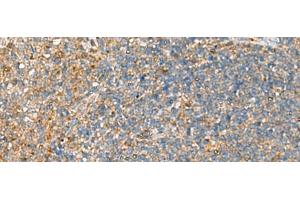 Immunohistochemistry of paraffin-embedded Human tonsil tissue using NQO2 Polyclonal Antibody at dilution of 1:70(x200) (NQO2 抗体)