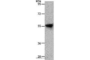 Western blot analysis of Human liver cancer tissue, using SLC1A4 Polyclonal Antibody at dilution of 1:800 (SLC1A4 抗体)