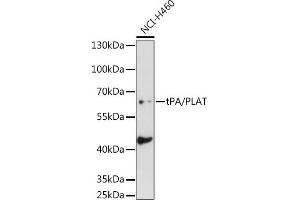 Western blot analysis of extracts of NCI-H460 cells, using tPA/tPA/PLAT antibody (ABIN6128802, ABIN6145743, ABIN6145744 and ABIN6221299) at 1:1000 dilution. (PLAT 抗体  (AA 23-320))