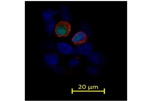 Immunostaining (ISt) image for anti-Transient Receptor Potential Cation Channel, Subfamily V, Member 3 (TRPV3) (AA 458-474) antibody (ABIN863127)