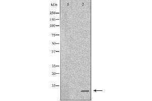 Western blot analysis of GST-SPINK1 recombinant protein using SPINK1 antibody. (SPINK1 抗体  (Internal Region))