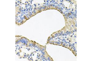 Immunohistochemistry of paraffin-embedded mouse lung using SKAP2 antibody. (SKAP2 抗体)