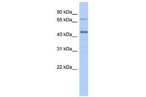USP12 antibody used at 1 ug/ml to detect target protein. (USP12 抗体  (Middle Region))