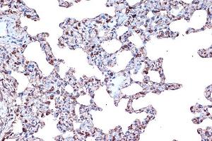Immunohistochemistry of paraffin-embedded rat lung using PDCD4 Rabbit mAb  at dilution of 1:100 (40x lens). (PDCD4 抗体)