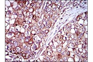 Immunohistochemistry (IHC) image for anti-Zinc Finger Protein 42 (ZFP42) (AA 249-310) antibody (ABIN1724852)