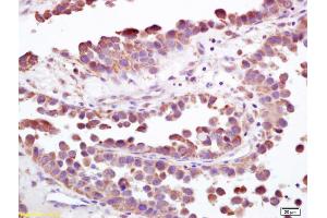 Immunohistochemistry (IHC) image for anti-S100 Calcium Binding Protein A9 (S100A9) (AA 51-114) antibody (ABIN749288)