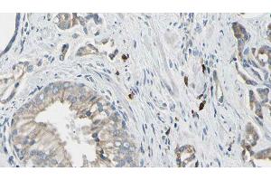 ABIN6278532 at 1/100 staining Human prostate tissue by IHC-P. (STEAP1 抗体  (N-Term))
