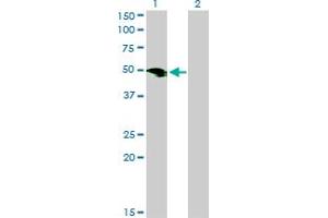 Western Blot analysis of SMOC1 expression in transfected 293T cell line by SMOC1 monoclonal antibody (M03), clone 8F10. (SMOC1 抗体  (AA 150-221))