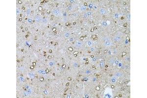Immunohistochemistry of paraffin-embedded Rat brain using NTF4 Polyclonal Antibody at dilution of 1:100 (40x lens). (Neurotrophin 4 抗体)
