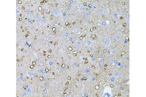 Immunohistochemistry of paraffin-embedded Rat brain using NTF4 Polyclonal Antibody at dilution of 1:100 (40x lens).
