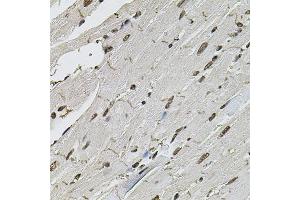 Immunohistochemistry of paraffin-embedded mouse heart using CTNNB1 antibody (ABIN5997534) at dilution of 1/100 (40x lens). (CTNNB1 抗体)