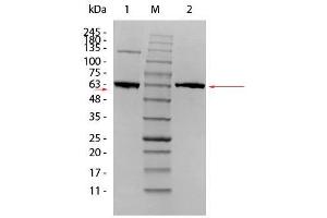 SDS-PAGE of AKT1 Human Recombinant Protein. (AKT1 蛋白)
