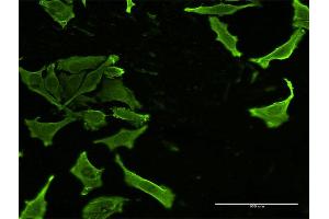 Immunofluorescence of monoclonal antibody to CKS2 on HeLa cell. (CKS2 抗体  (AA 1-79))