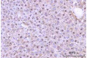 IHC analysis of Nesprin3/SYNE3 using anti-Nesprin3/SYNE3 antibody (ABIN7601328). (Nesprin3 抗体  (AA 322-495))