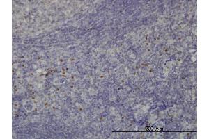 Immunoperoxidase of monoclonal antibody to TCF12 on formalin-fixed paraffin-embedded human tonsil. (TCF12 抗体  (AA 364-453))