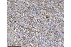 IHC analysis of Integrin linked ILK using anti-Integrin linked ILK antibody (ABIN7599410). (ILK 抗体  (AA 1-452))