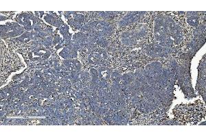 IHC analysis of L/CMBL using anti-L/CMBL antibody (ABIN7599150).