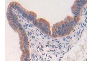 Immunohistochemistry (IHC) image for anti-Thymidine Phosphorylase (TYMP) (AA 29-305) antibody (ABIN7432934)