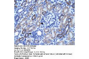 Human kidney (ASIC3 抗体  (N-Term))