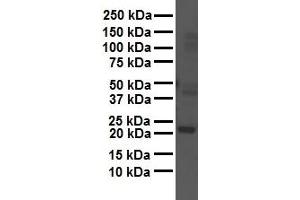 WB Suggested Anti-GAMT antibody Titration: 1 ug/mL Sample Type: Human liver (GAMT 抗体  (Middle Region))