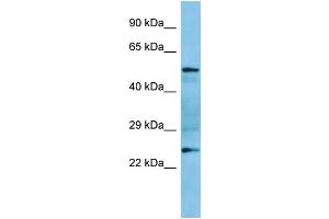 Host: Rabbit Target Name: Grap Antibody Dilution: 1. (GRAP 抗体  (Middle Region))