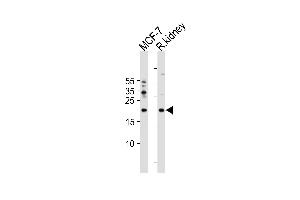 Western blot analysis in MCF-7 cell line and rat kidney tissue lysates (35ug/lane). (APRT 抗体  (C-Term))